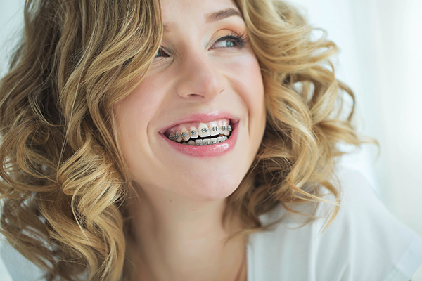 Traditional Metal Braces In Tuckahoe, Eastchester, Bronxville NY