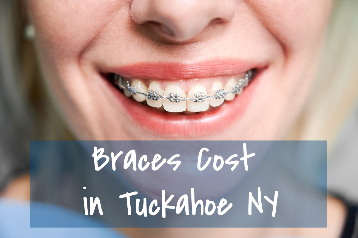 braces cost tuckahoe NY