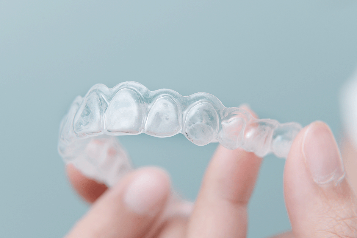 what makes clear aligners different