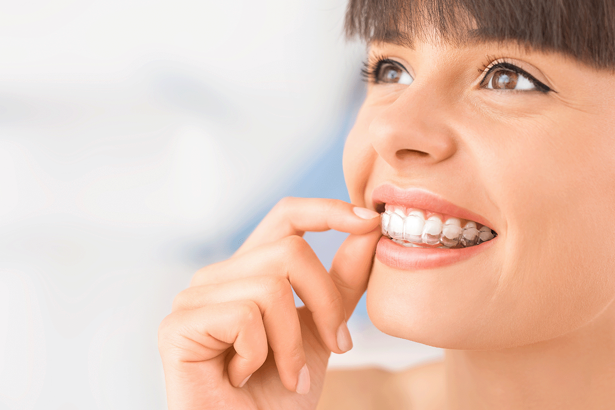 who can use clear aligners?